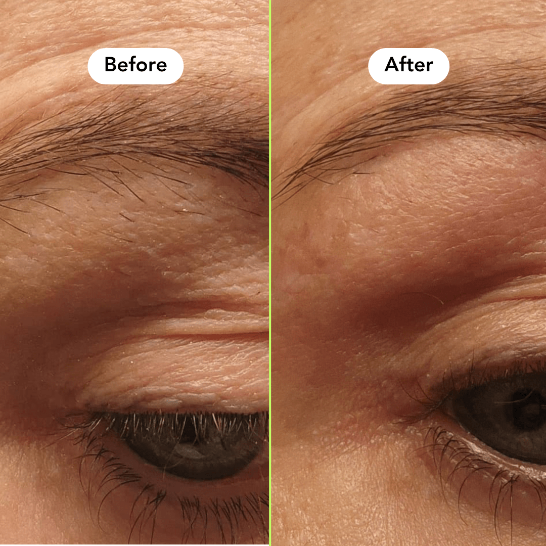 Face & Eyebrow Hair Removal Jar