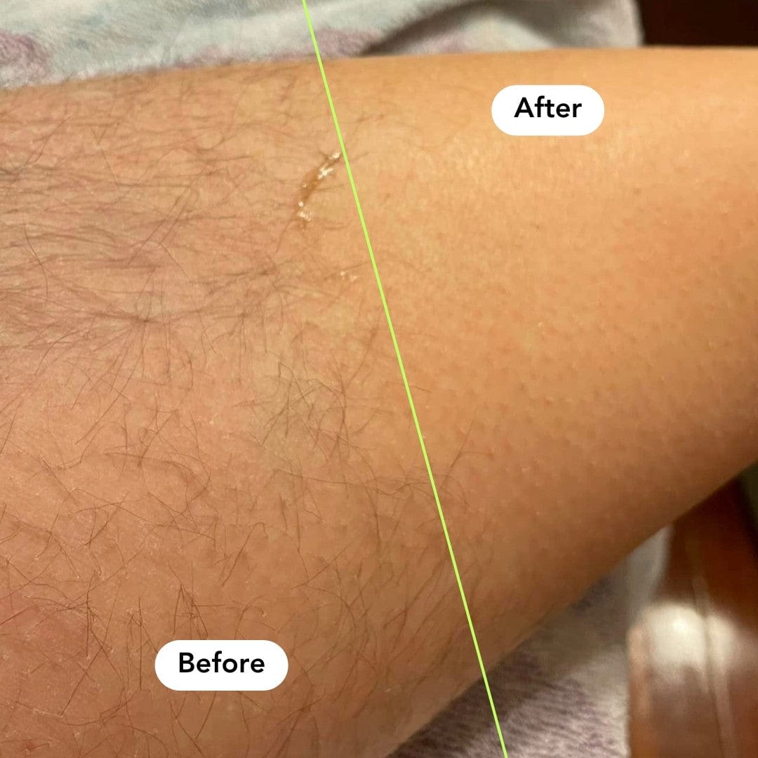 Body Hair Removal Jar - 175g