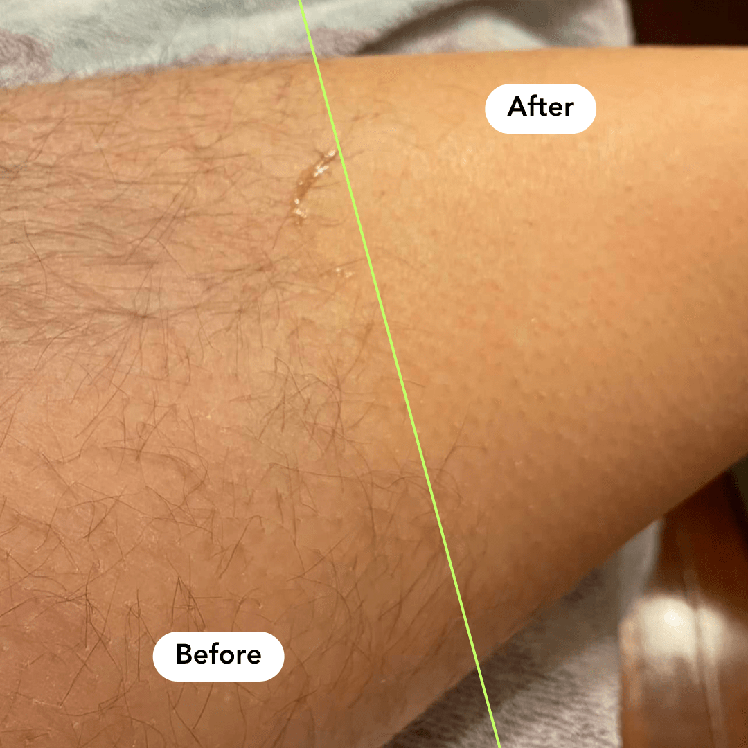 Deluxe Hair Removal & Smooth Skin Regimen (Exfoliate + Hydrate)