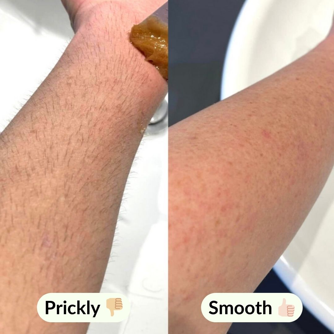 Before and after of prickly hair, then smooth skin after using sugar me smooth body hair removal sugar wax