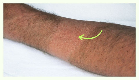 Tutorial: Get Rid of Arm Hair