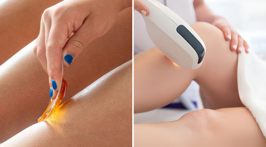 laser hair removal vs sugaring