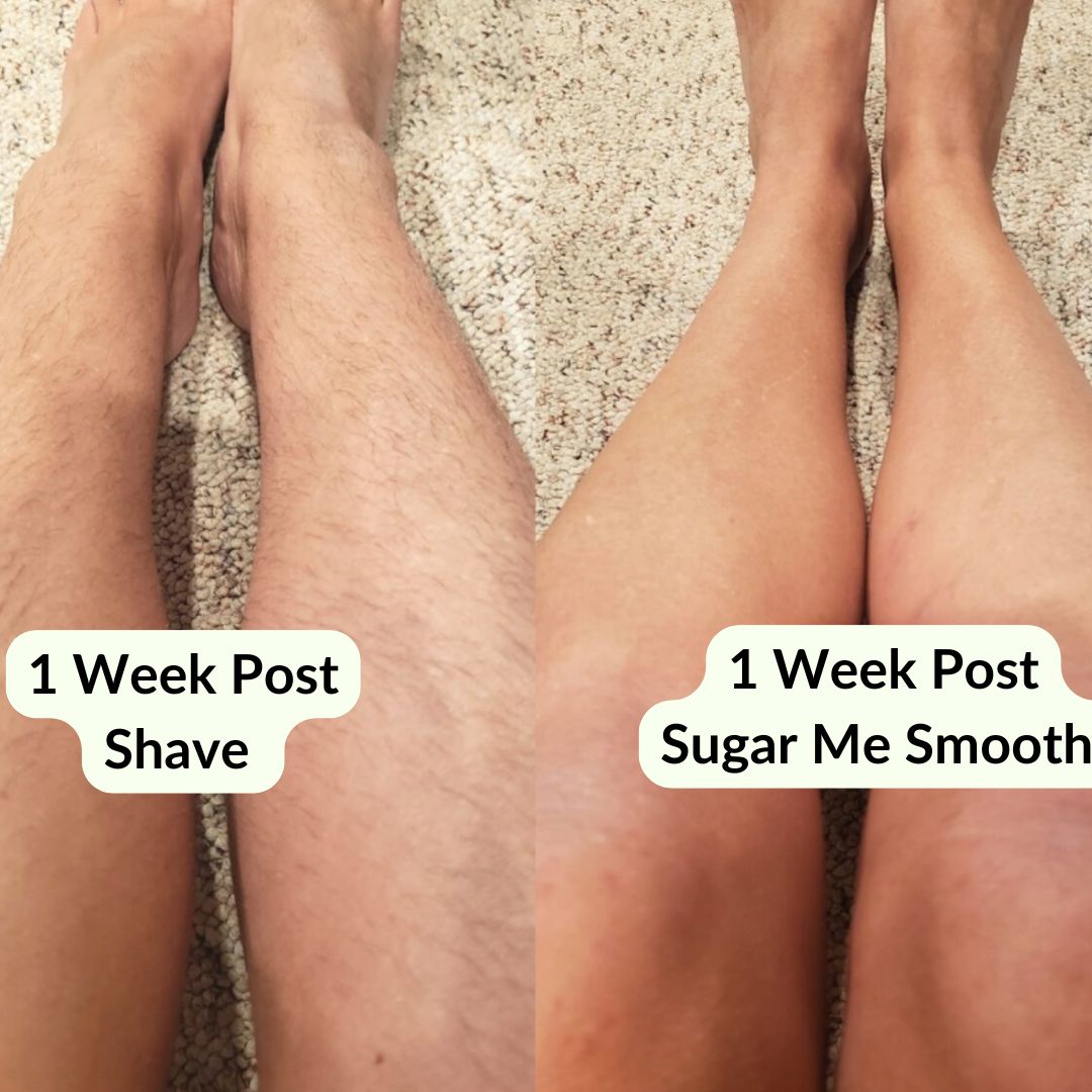 Before and after of woman's legs using Sugar Me Smooth Body Sugar Wax. W eek post shave with long hair, and 1 week post sugar me smooth with smooth hairless skin