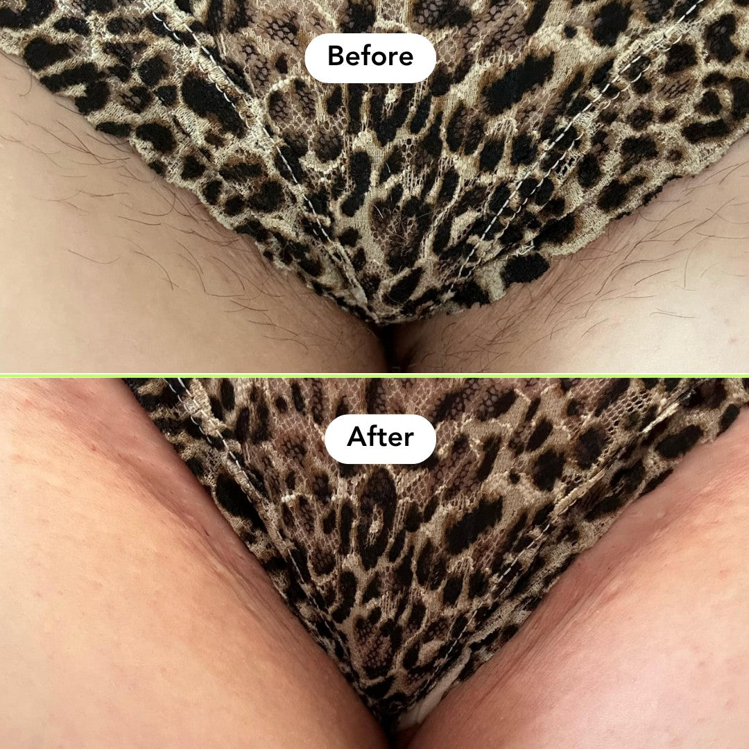 Full Body Hair Removal Kit