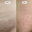 Bikini Hair Removal Jar