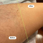 Deluxe Hair Removal Kit (Body + Bikini)