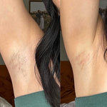 Deluxe Hair Removal Kit + Essential Tools